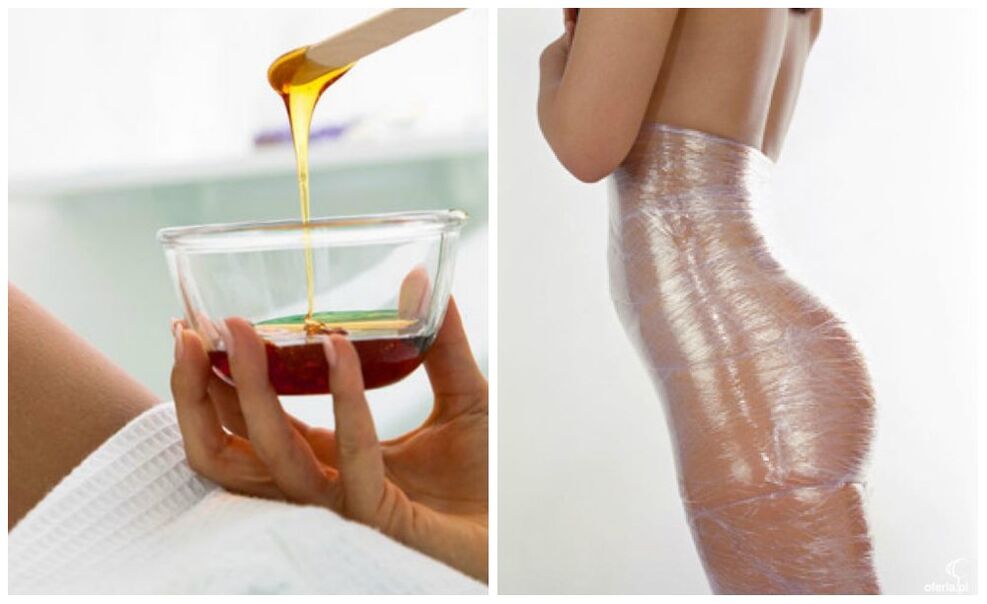 gorputz-bilgarriak pisua galtzeko